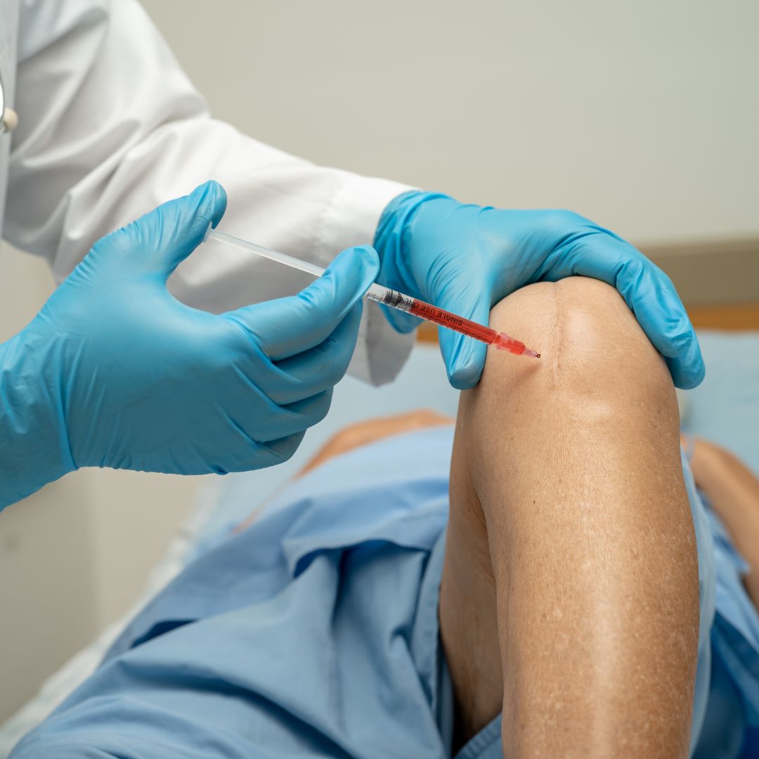 Infiltração articular com ácido hialurônico no joelho em consultório