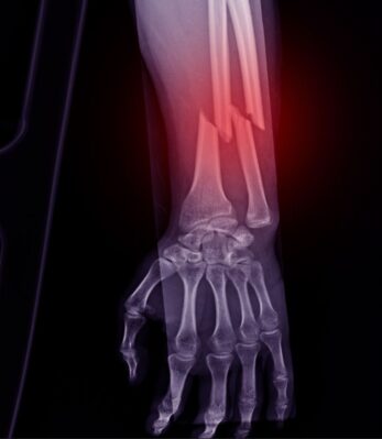 servicos-cirurgia-trauma-ortopedico-medico-ortopedista-manhuacu-mg